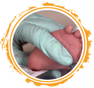 Newborn Screening Heel Prick